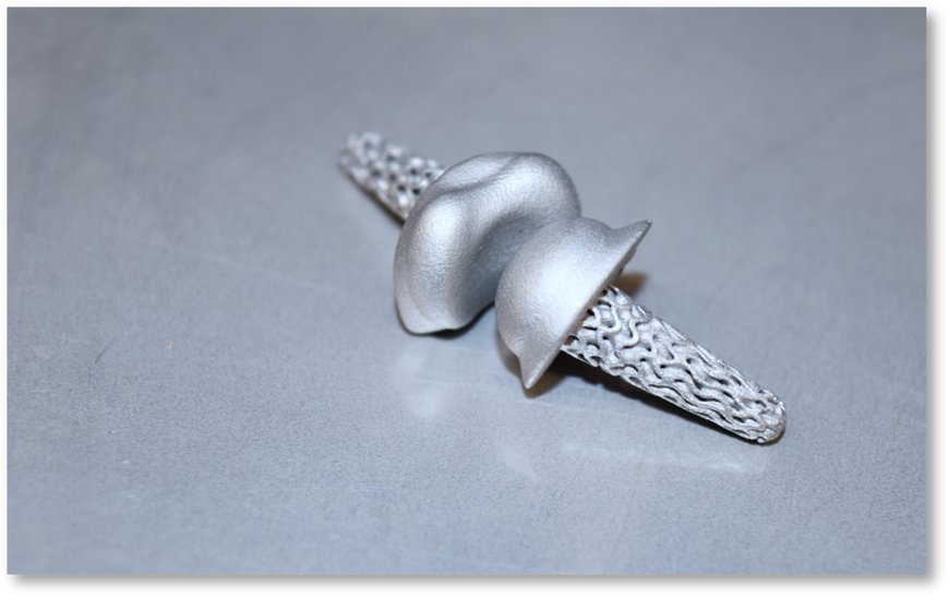 Mehr Beweglichkeit durch KI: Individualisierte Fingergelenksimplantate aus dem 3D-Drucker